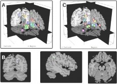 BrainModulyzer1