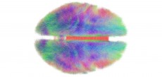 The Human Connectome copy