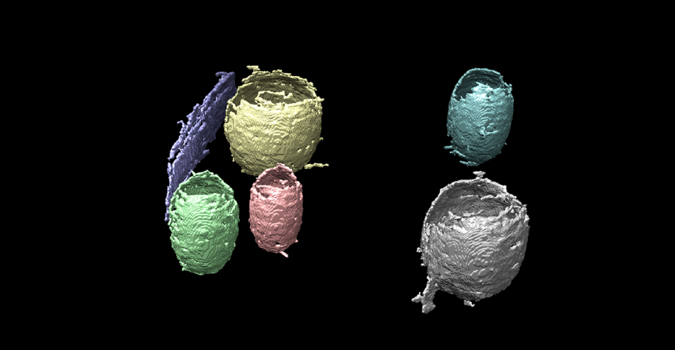 Tomography Data Set